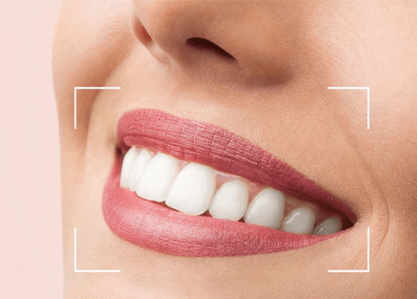 اصلاح طرح لبخند