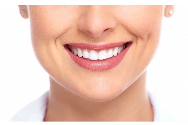 بهترین-روکش-دندان-تهران