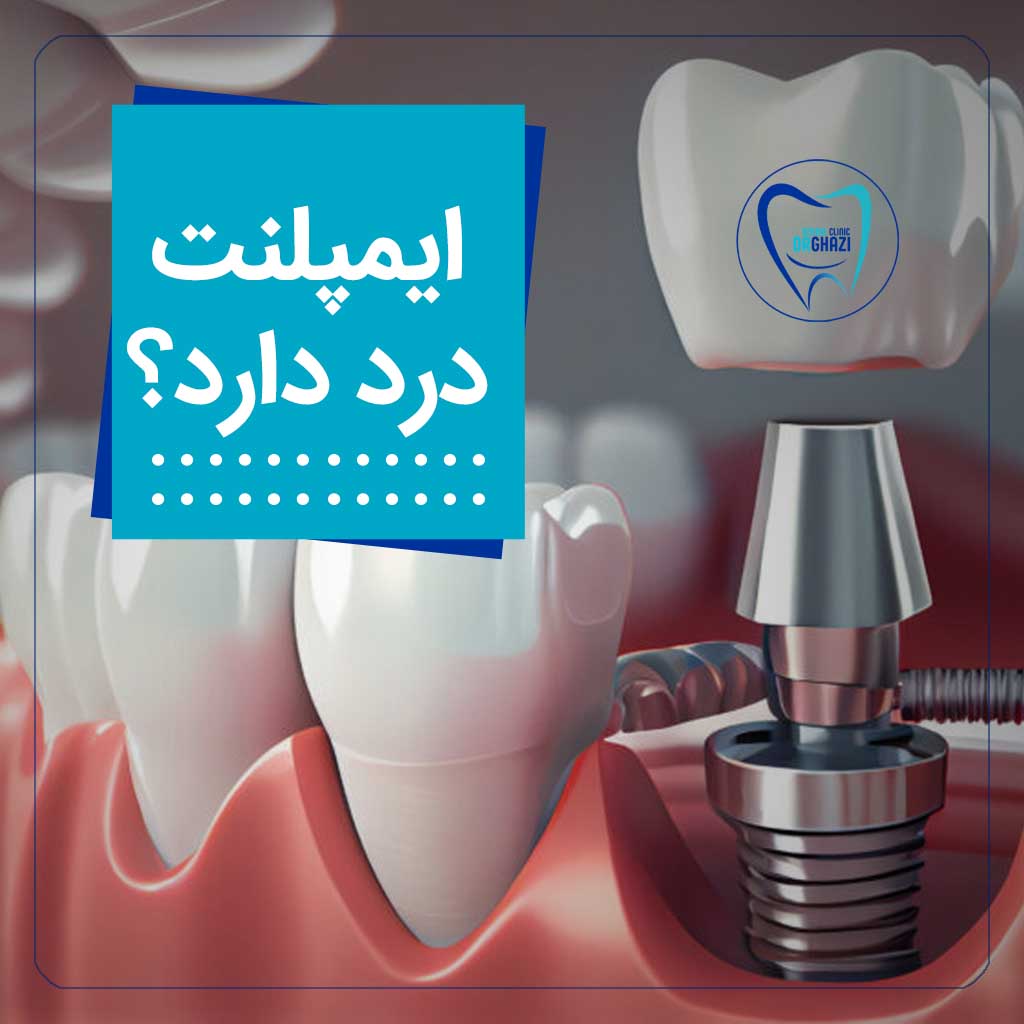 ایمپلنت دندان درد دارد؟