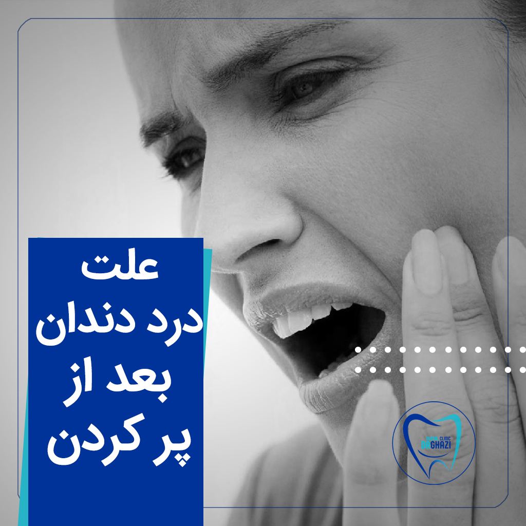 درد دندان بعد از پر کردن