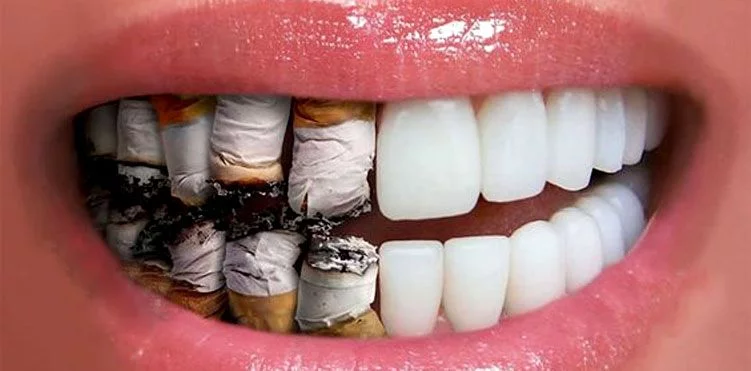 عوامل مخرب بر سلامت دهان و دندان