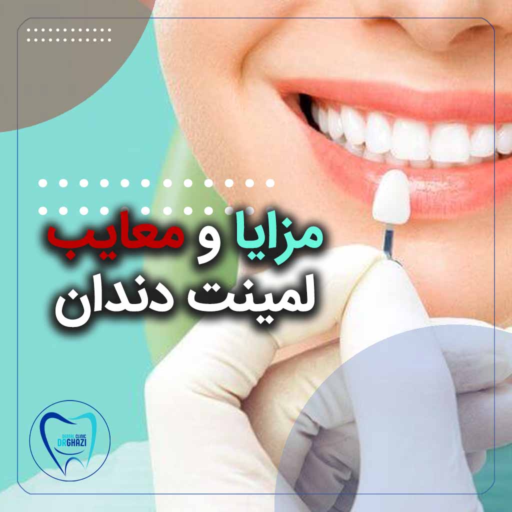 لمینت دندانپزشکی سعادت آباد