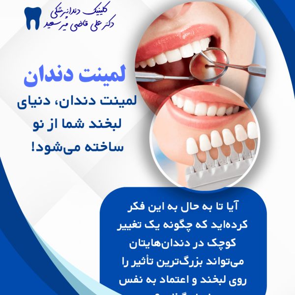 لمینت دندان سعادت آباد