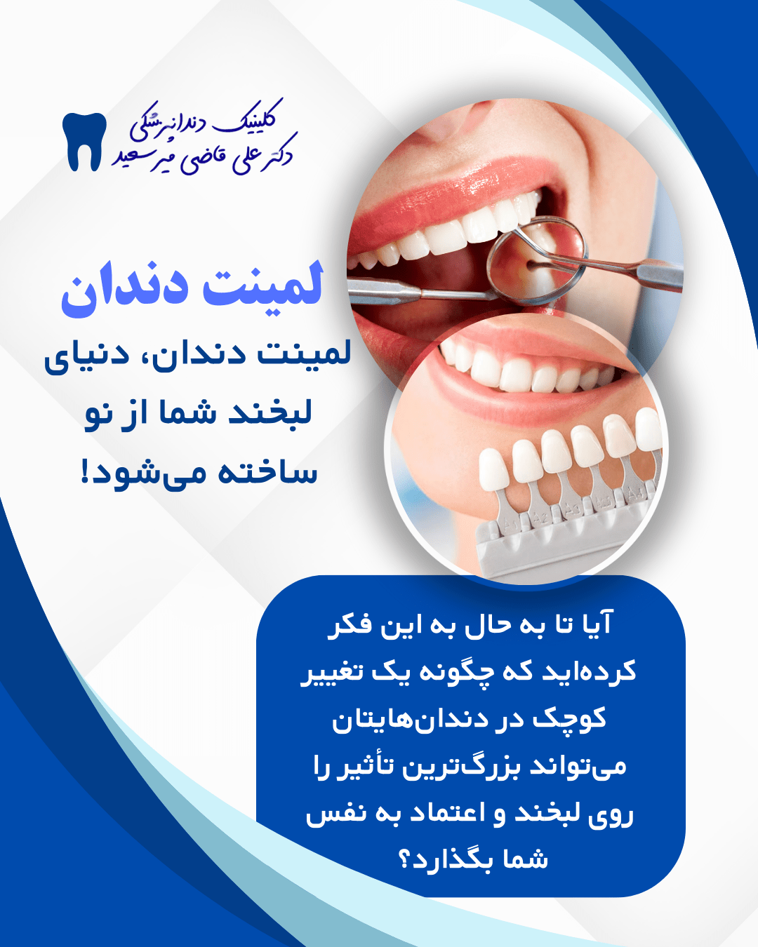 لمینت دندان سعادت آباد