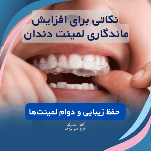 ماندگاری لمینت دندان