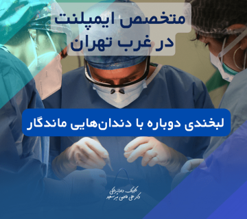 متخصص ایمپلنت در غرب تهران ،انجام جراحی ایمپلنت