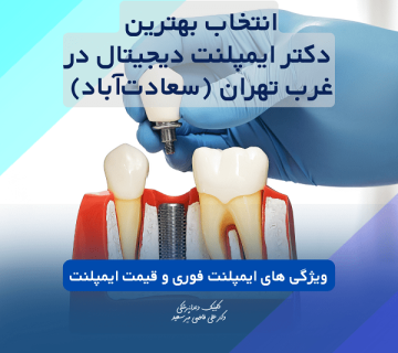 متخصص ایمپلنت در غرب تهران