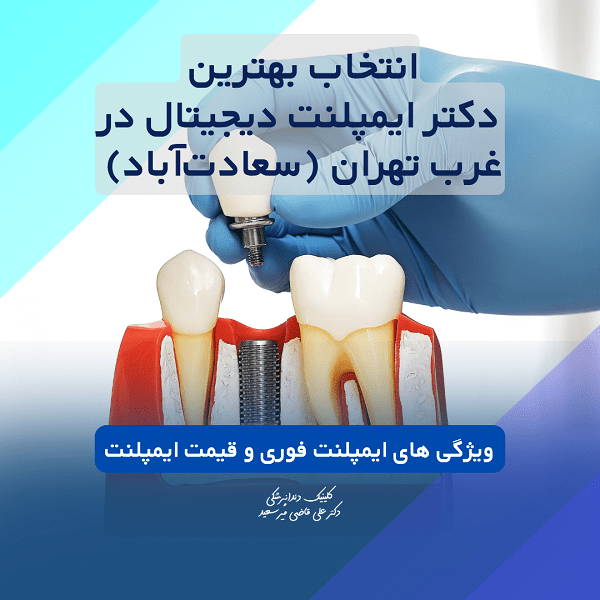 متخصص ایمپلنت در غرب تهران