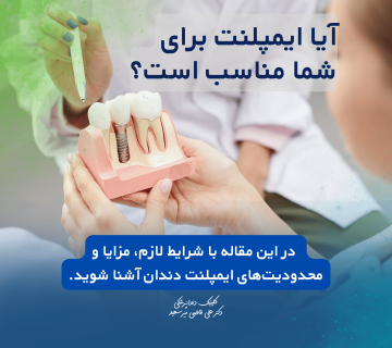 آیا ایمپلنت دندان برای شما مناسب است؟