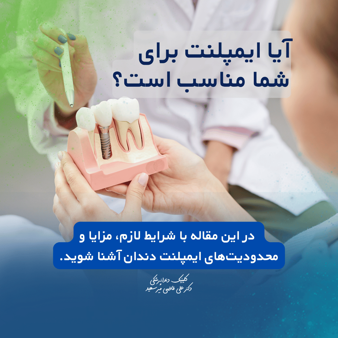 آیا ایمپلنت دندان برای شما مناسب است؟