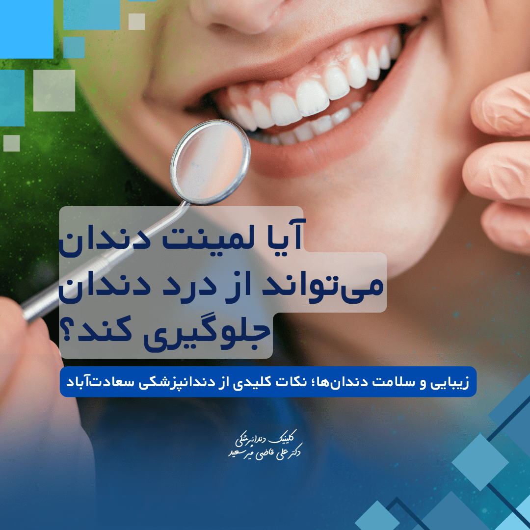 بررسی تاثیر لمینت دندان بر درد دندان