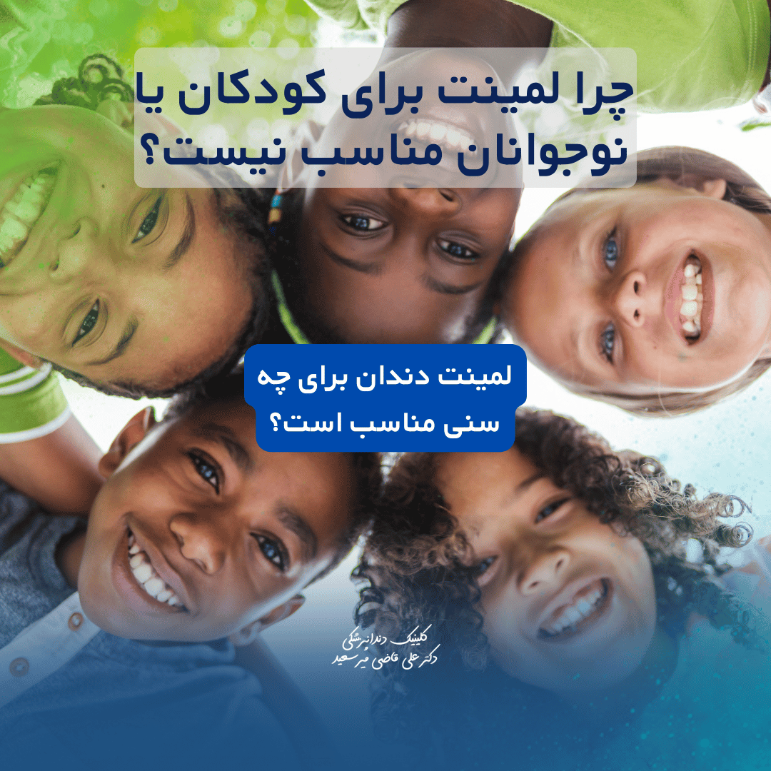 چرا لمینت دندان برای کودکان و نوجوانان مناسب نیست؟ | دندانپزشکی سعادت‌آباد