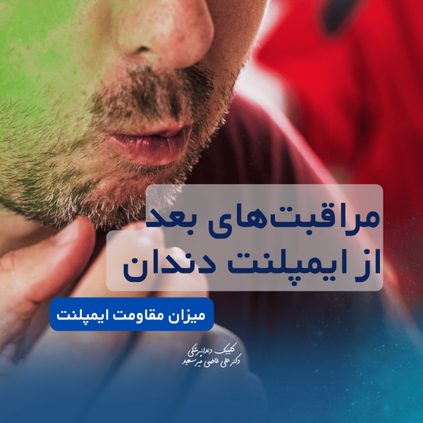 مراقبتهای بعد از ایمپلنت دندان