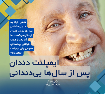 ایمپلنت دندان پس از بی‌دندانی طولانی