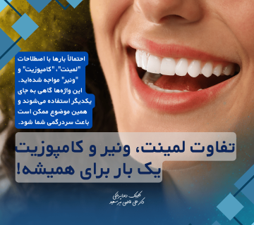 تفاوت لمینت، ونیر و کامپوزیت؛ یک بار برای همیشه!