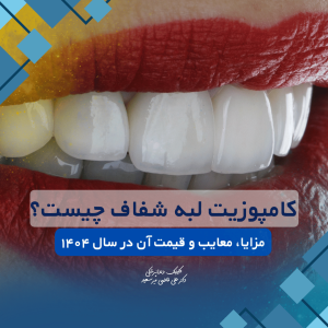 کامپوزیت لبه شفاف در غرب تهران