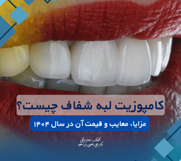 کامپوزیت لبه شفاف در غرب تهران