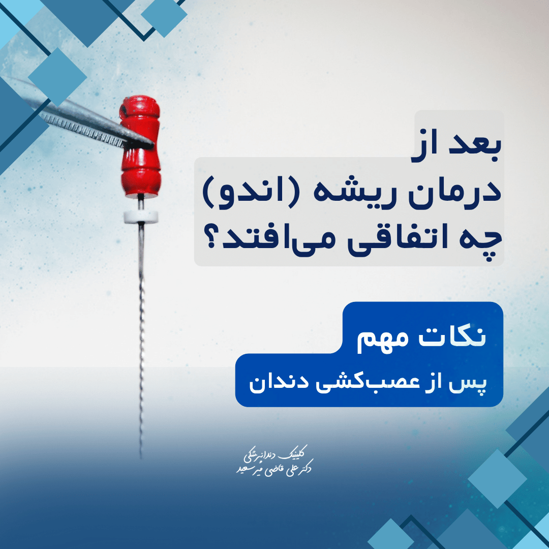 درمان ریشه دندان (اندو)