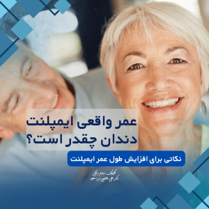 عمر واقعی ایمپلنت چقدر است؟