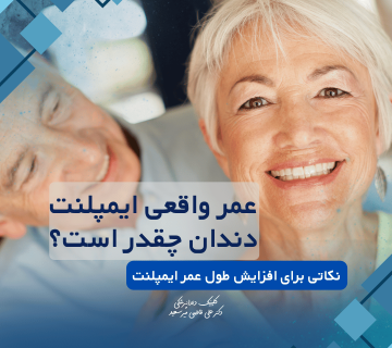 عمر واقعی ایمپلنت چقدر است؟