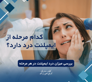 ایمپلنت دندان در کدام مرحله درد دارد