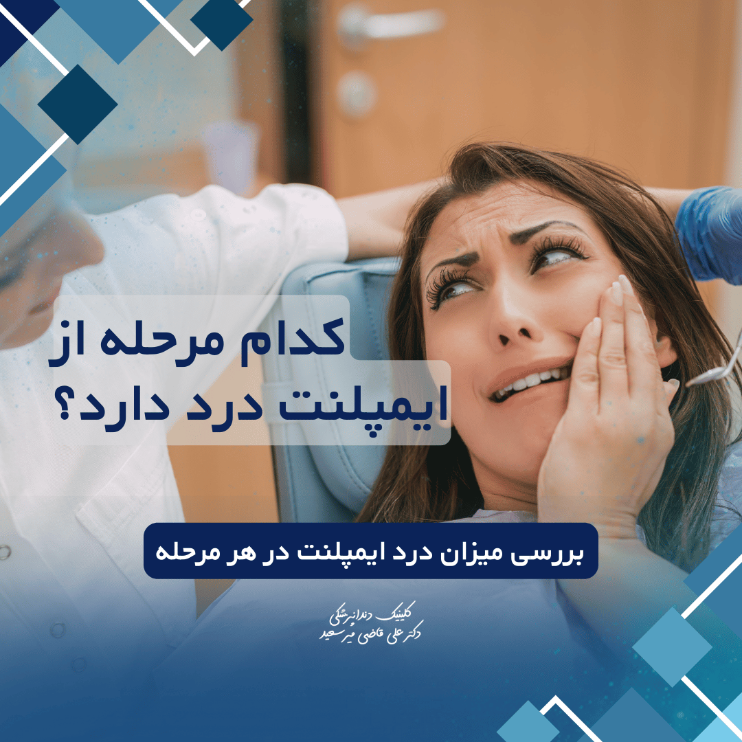 ایمپلنت دندان در کدام مرحله درد دارد