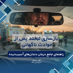 درمان تخصصی دندان‌های آسیب‌دیده در حادثه