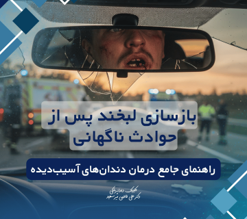 درمان تخصصی دندان‌های آسیب‌دیده در حادثه