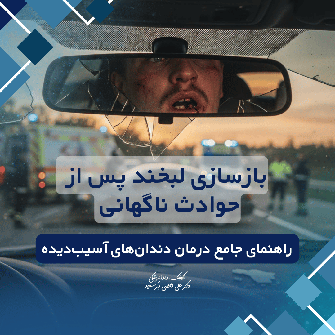 درمان تخصصی دندان‌های آسیب‌دیده در حادثه