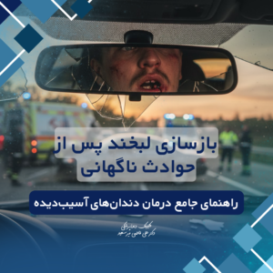 بازسازی دندان آسیب دیده پس از حوادث