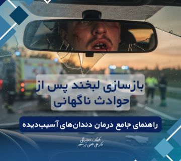 بازسازی دندان آسیب دیده پس از حوادث