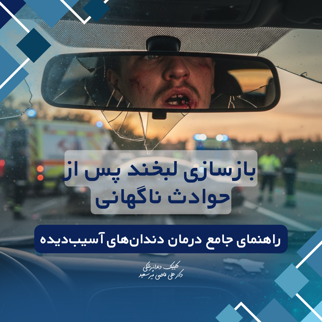 بازسازی دندان آسیب دیده پس از حوادث