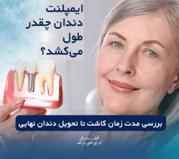ایمپلنت دندان چقدر طول می‌کشد؟