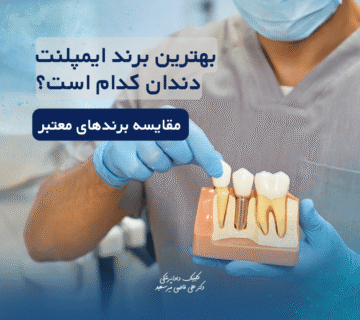 بهترین برند ایمپلنت دندان کدام است؟