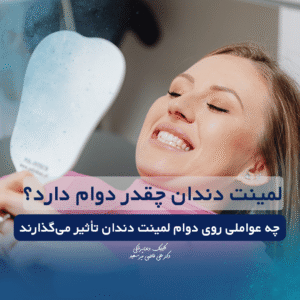 دوام لمینت دندان