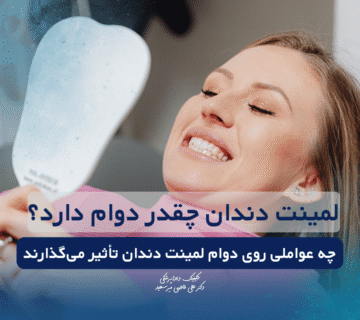 دوام لمینت دندان