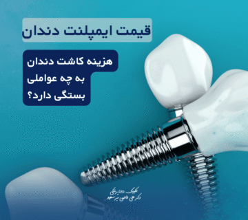 قیمت ایمپلنت دندان سعادت آباد