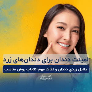 لمینت دندان برای دندان‌های زرد