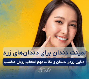 لمینت دندان برای دندان‌های زرد