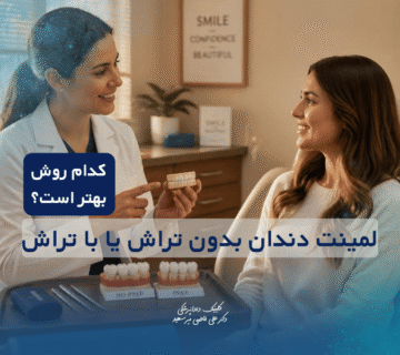 لمینت دندان بدون تراش یا با تراش؛ کدام روش بهتر است؟
